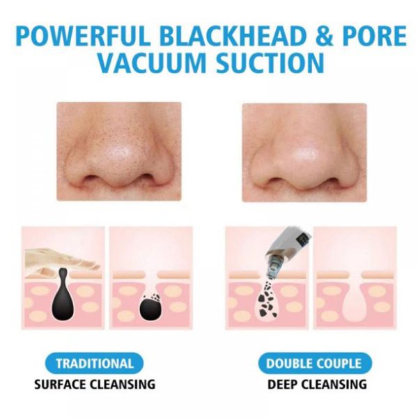 Electric Blackhead Pore Cleaning  Suction